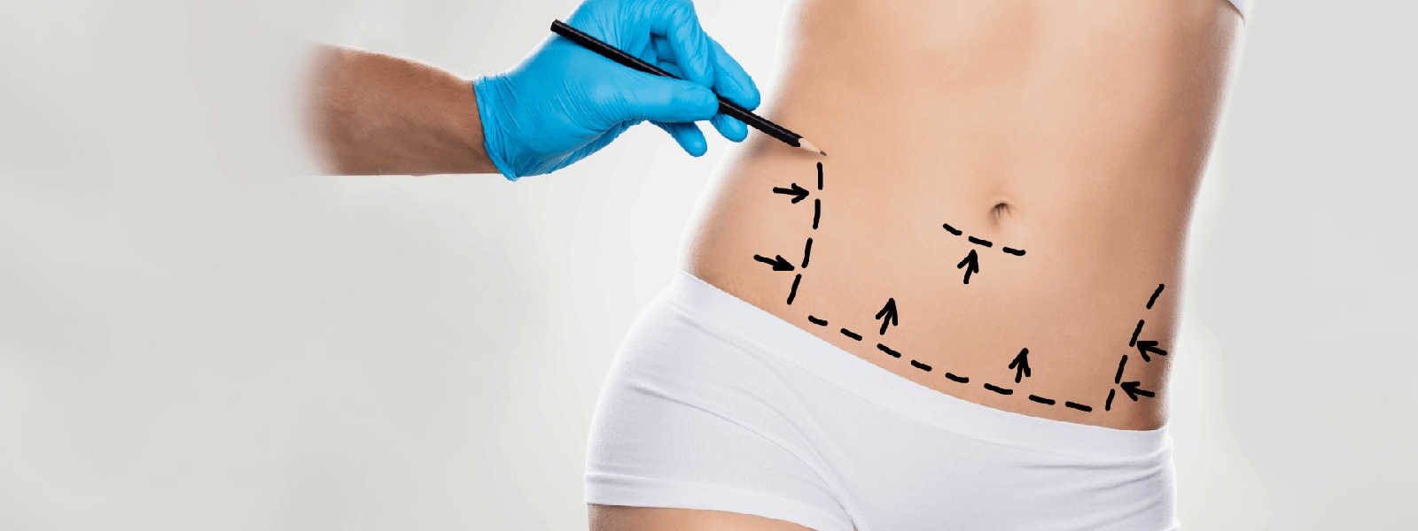 Centre for Surgery on X: How To Get Rid Of Stomach Overhang & Belly Fat    / X